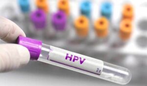 Çanakkale Belediyesi ücretsiz HPV aşısı kampanyası başlatıyor